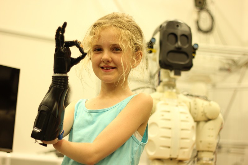 Open-Bionics-10-year-old-Tilly-web