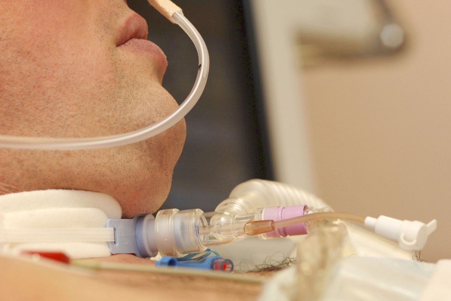 Improving tracheostomy care during Covid