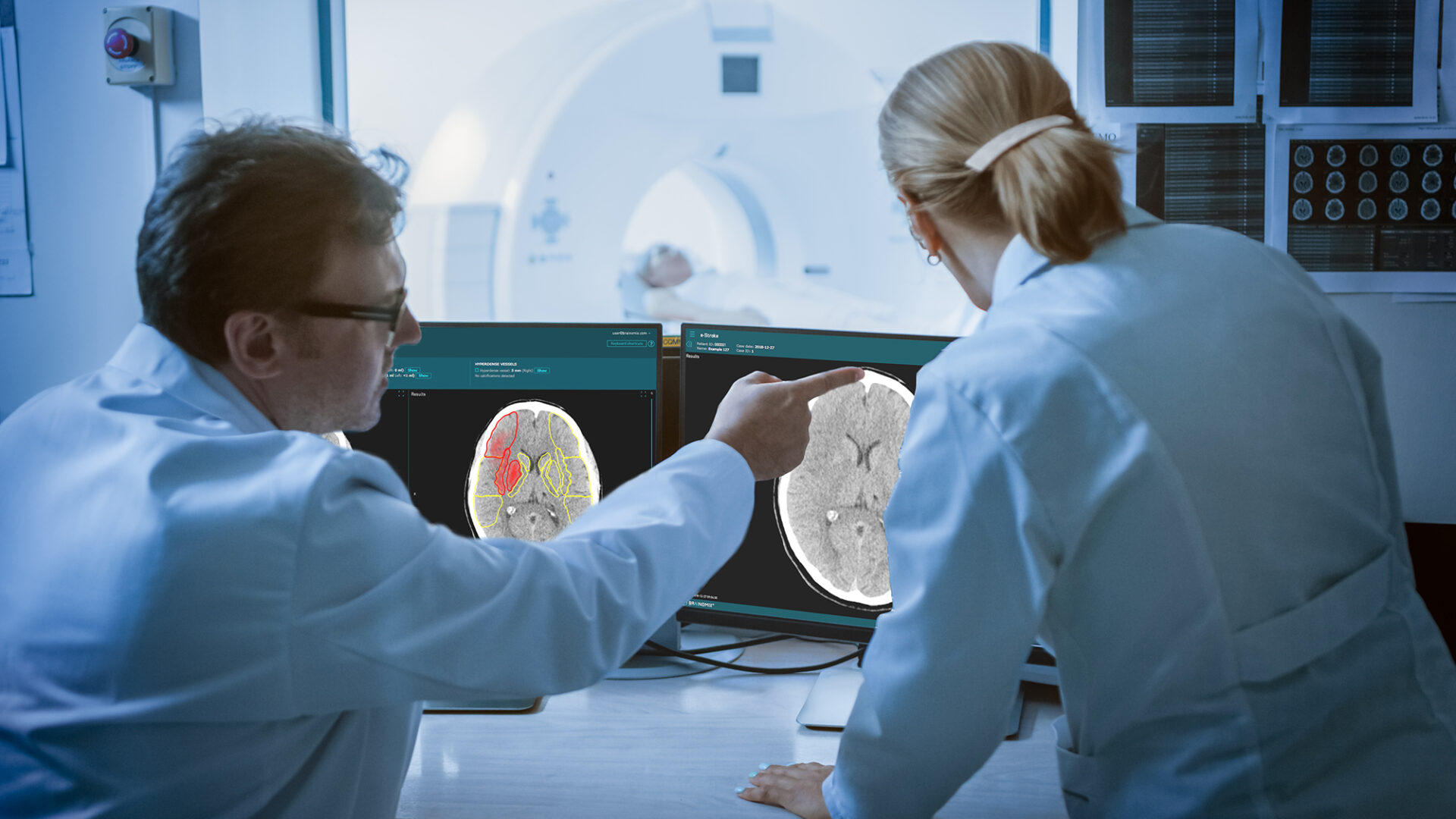 Harnessing AI to speed up access to stroke care